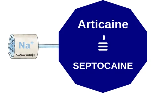Articaine ballicule — decagon mechanism diagram